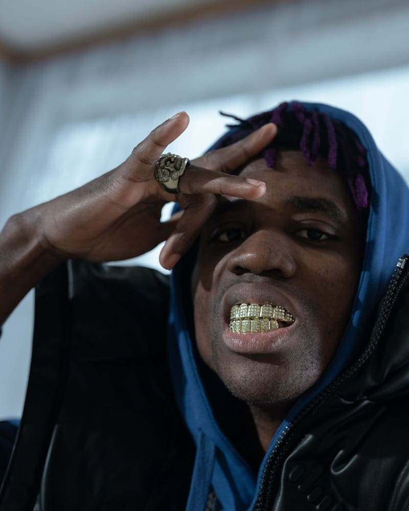 Custom gold grillz worn with a hoodie